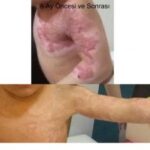 Oncesi-ve-Sonras1-1-300x225