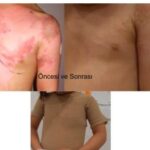 Oncesi-ve-Sonras4-1-300x225